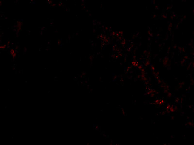 PIST Antibody in Immunocytochemistry (ICC/IF)