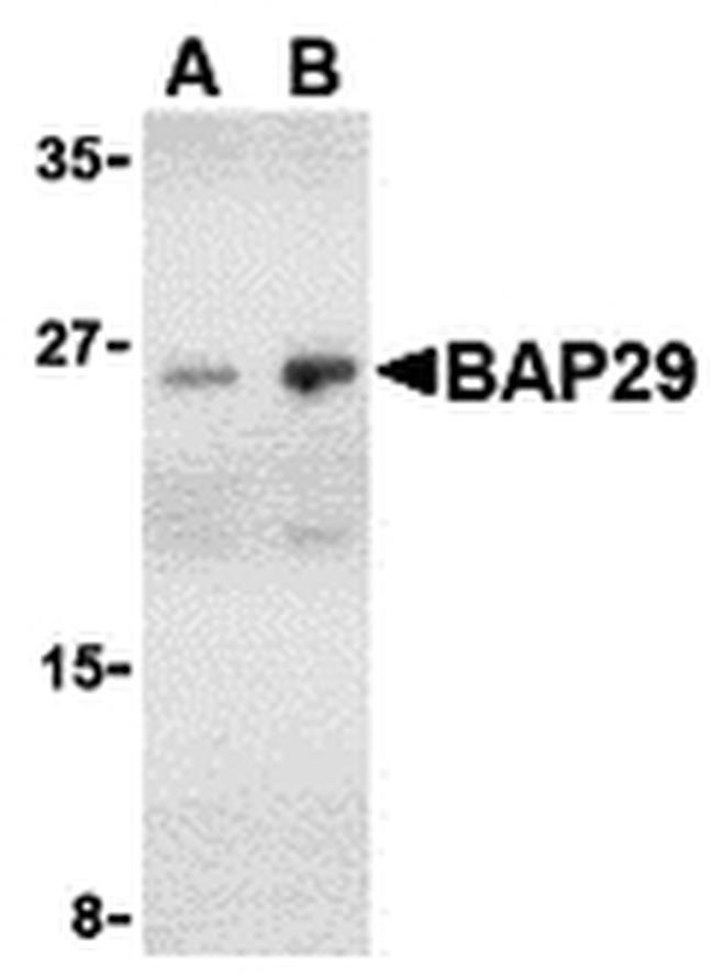 BAP29 Antibody in Western Blot (WB)