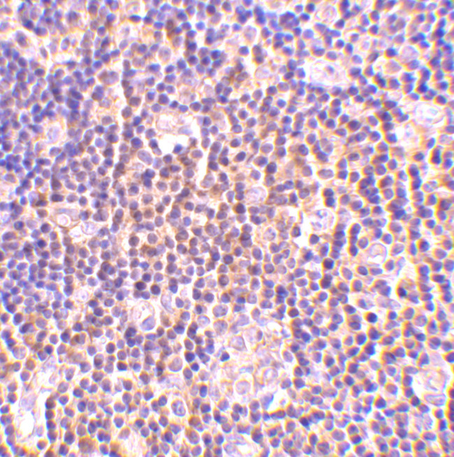 BAG1 Antibody in Immunohistochemistry (IHC)