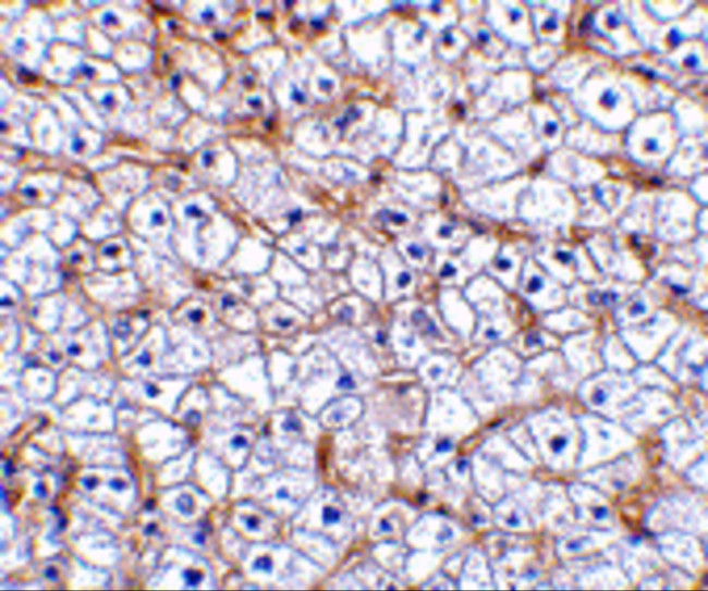 CD266 Antibody in Immunohistochemistry (IHC)