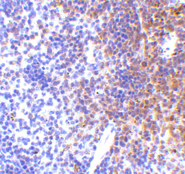 IRF7 Antibody in Immunohistochemistry (IHC)