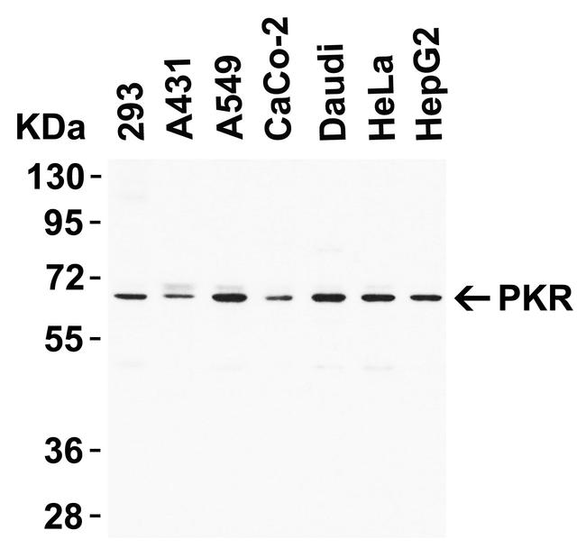 PKR Antibody in Western Blot (WB)