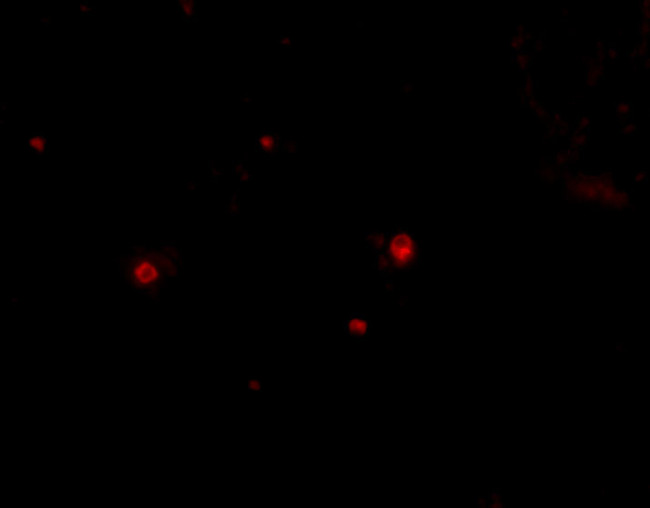 STIM2 Antibody in Immunocytochemistry (ICC/IF)