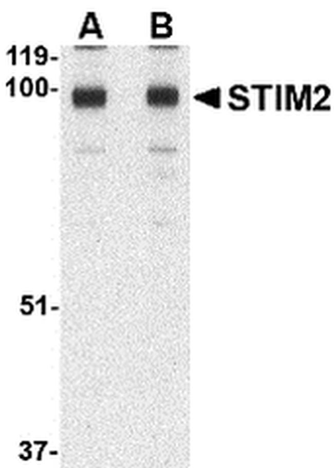 STIM2 Antibody in Western Blot (WB)