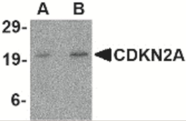 p16INK4a Antibody in Western Blot (WB)