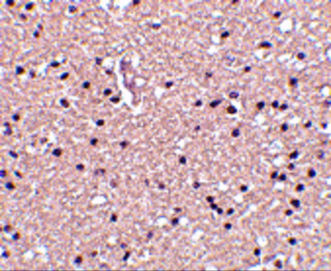 Stathmin 1 Antibody in Immunohistochemistry (Paraffin) (IHC (P))