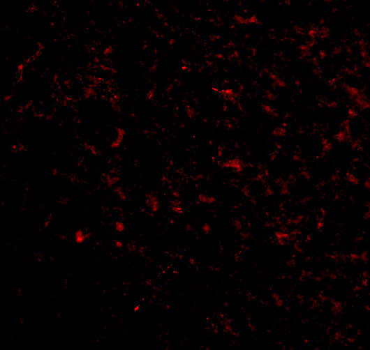 GRIK5 Antibody in Immunocytochemistry (ICC/IF)