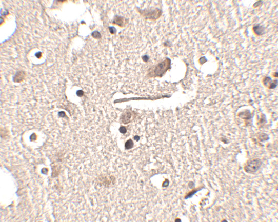 SLITRK2 Antibody in Immunohistochemistry (IHC)