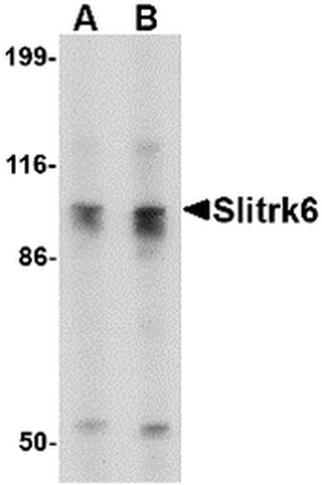 SLITRK6 Antibody in Western Blot (WB)