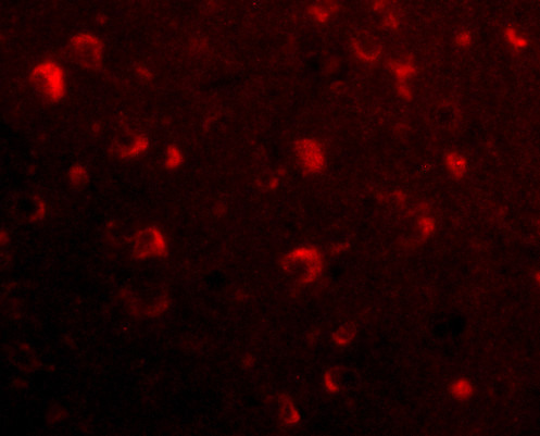 SLITRK6 Antibody in Immunocytochemistry (ICC/IF)