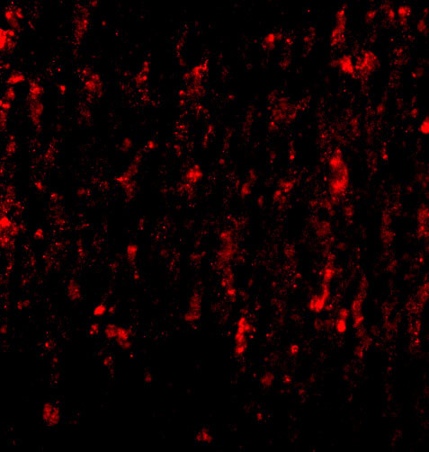 SATB2 Antibody in Immunocytochemistry (ICC/IF)