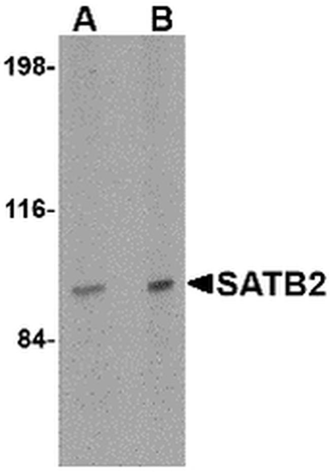 SATB2 Antibody in Western Blot (WB)