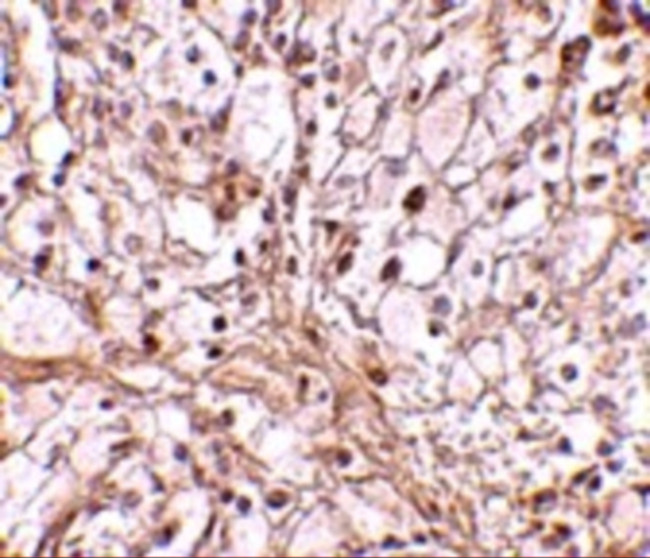 TRIM30 Antibody in Immunohistochemistry (IHC)