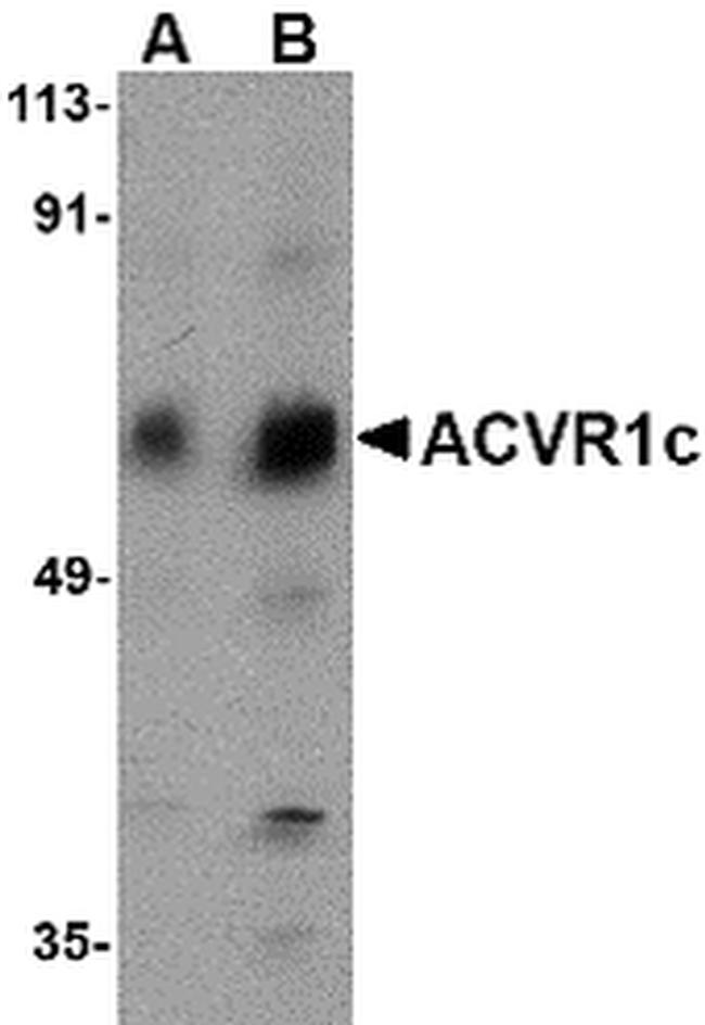 ACVR1C Antibody in Western Blot (WB)