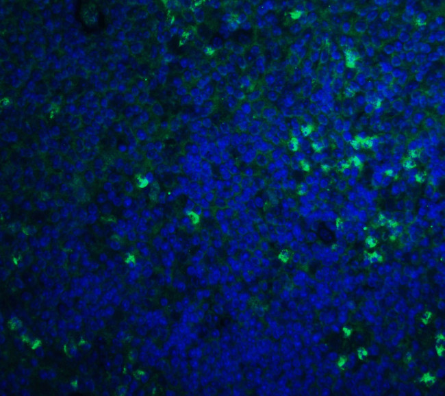 S1P1 Antibody in Immunohistochemistry (IHC)