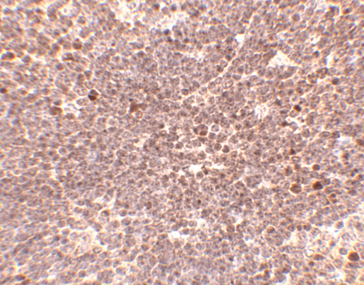 S1P1 Antibody in Immunohistochemistry (IHC)