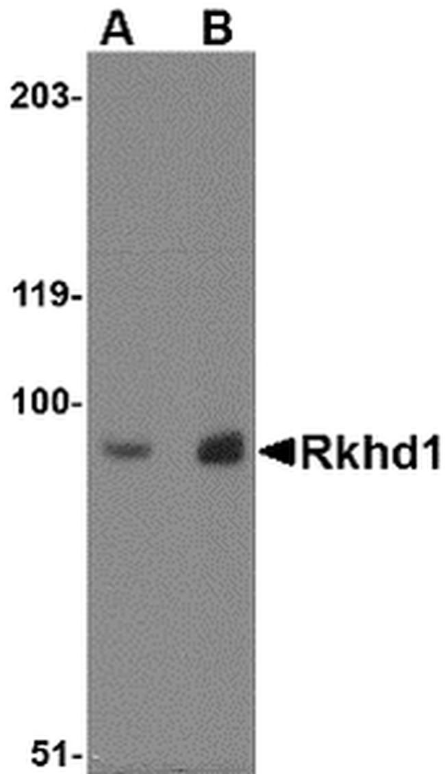 RKHD1 Antibody in Western Blot (WB)
