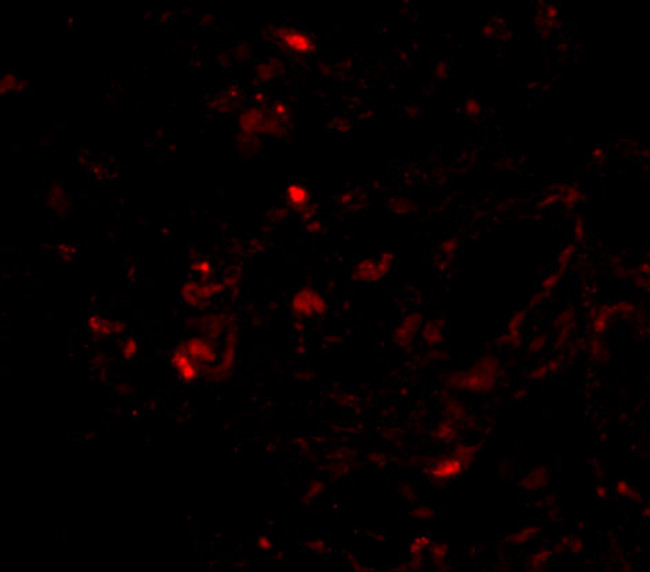 Transthyretin Antibody in Immunohistochemistry (IHC)