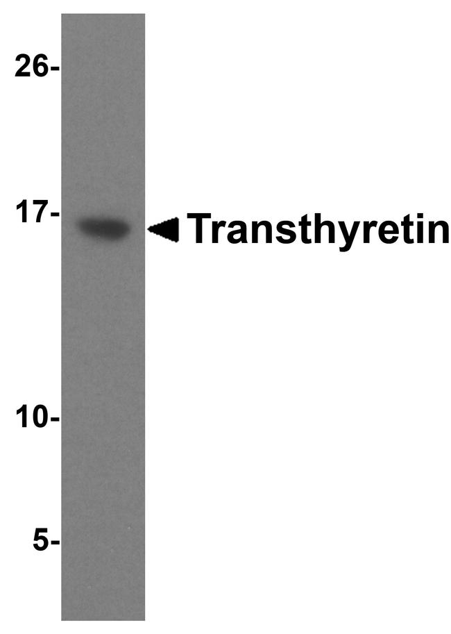 Transthyretin Antibody in Western Blot (WB)