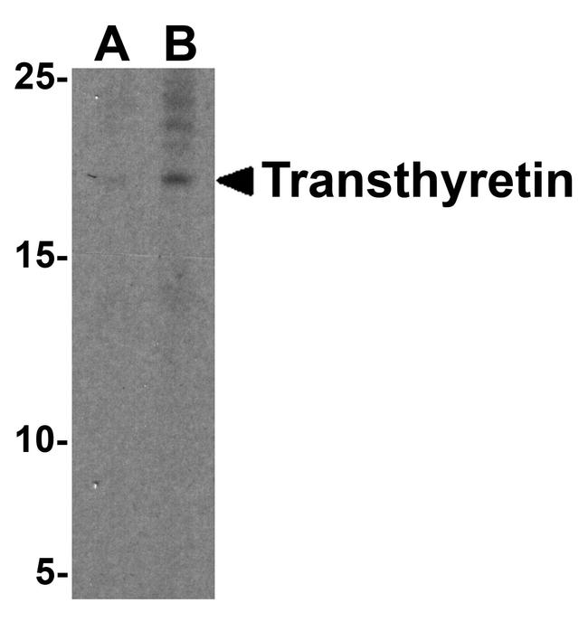 Transthyretin Antibody in Western Blot (WB)