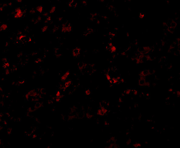 AP2M1 Antibody in Immunocytochemistry (ICC/IF)