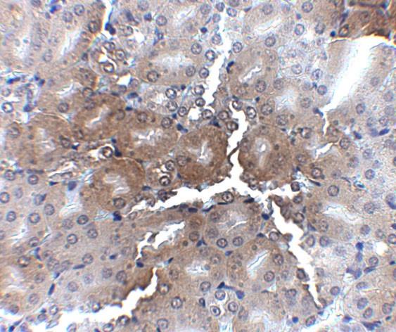 AP2M1 Antibody in Immunohistochemistry (IHC)