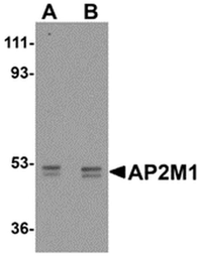 AP2M1 Antibody in Western Blot (WB)