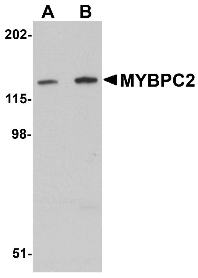 MYBPC2 Antibody in Western Blot (WB)