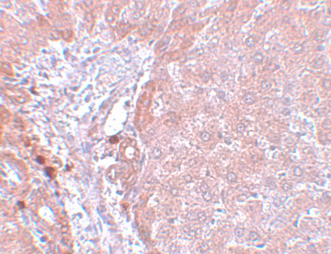 NDUFB9 Antibody in Immunohistochemistry (IHC)