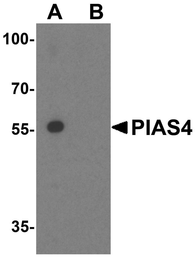 PIASy Antibody in Western Blot (WB)