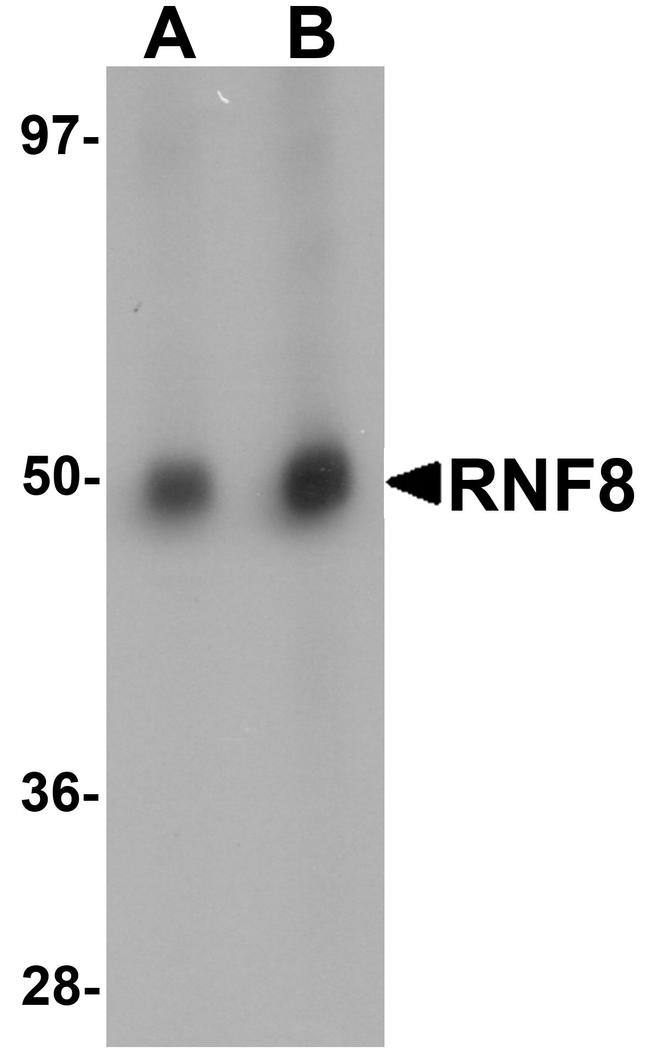 RNF8 Antibody in Western Blot (WB)