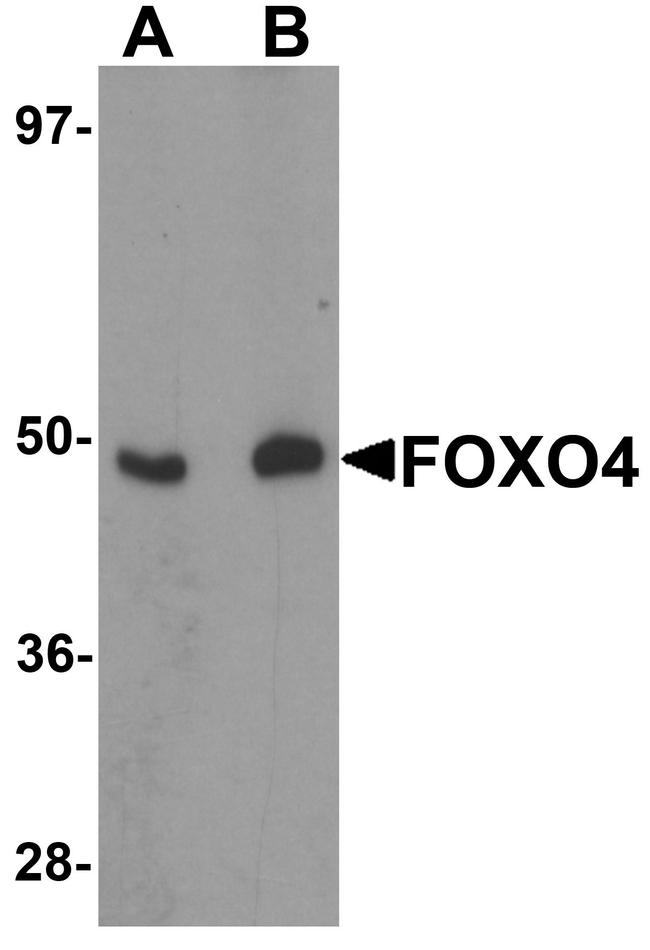 FOXO4 Antibody in Western Blot (WB)