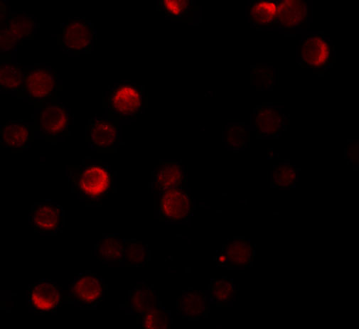 ZC3HAV1 Antibody in Immunocytochemistry (ICC/IF)