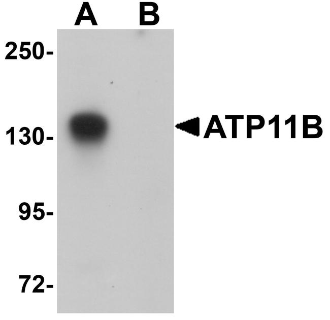 ATP11B Antibody in Western Blot (WB)