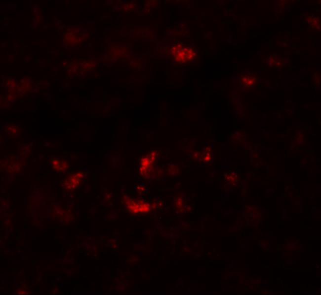 PIWIL1 Antibody in Immunohistochemistry (IHC)