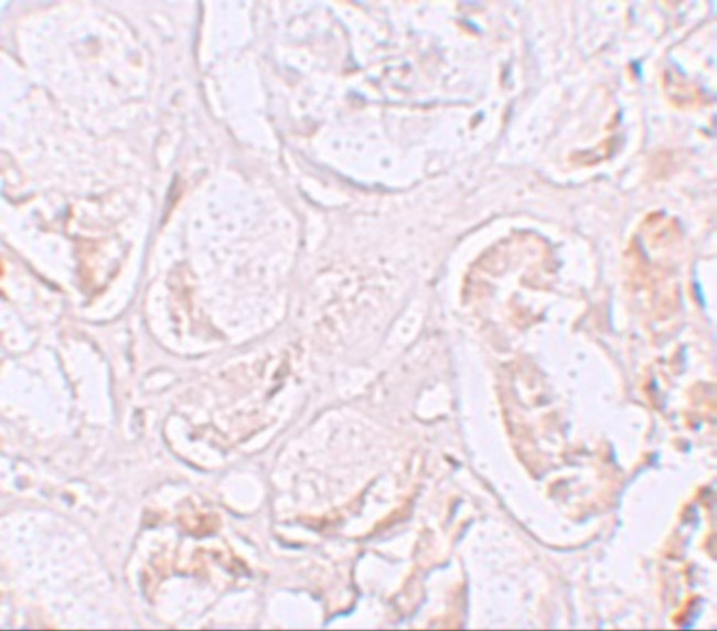 SLAMF9 Antibody in Immunohistochemistry (IHC)