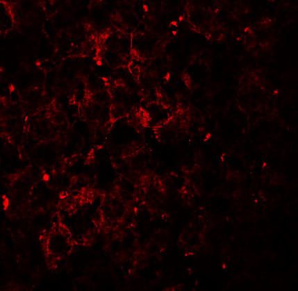 VPS39 Antibody in Immunohistochemistry (IHC)