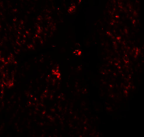 RHAMM Antibody in Immunohistochemistry (IHC)