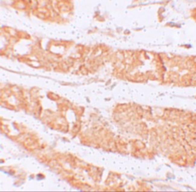 RHAMM Antibody in Immunohistochemistry (IHC)