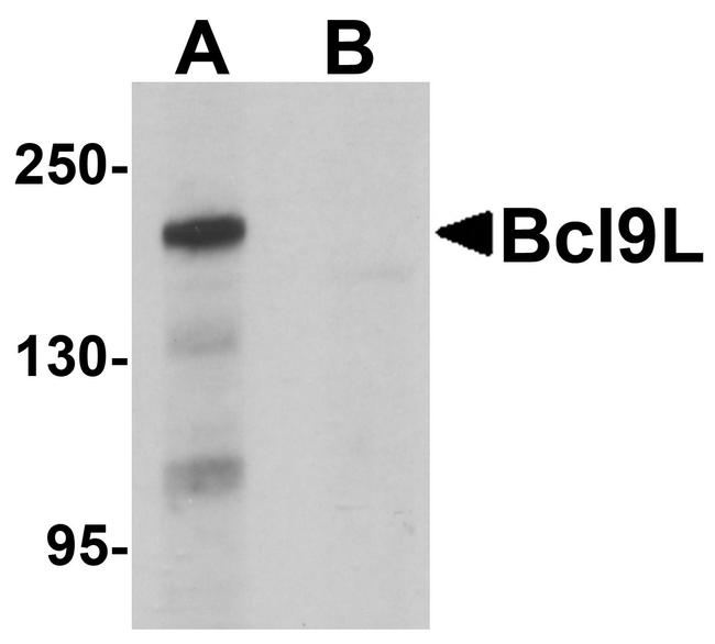 BCL9L Antibody in Western Blot (WB)