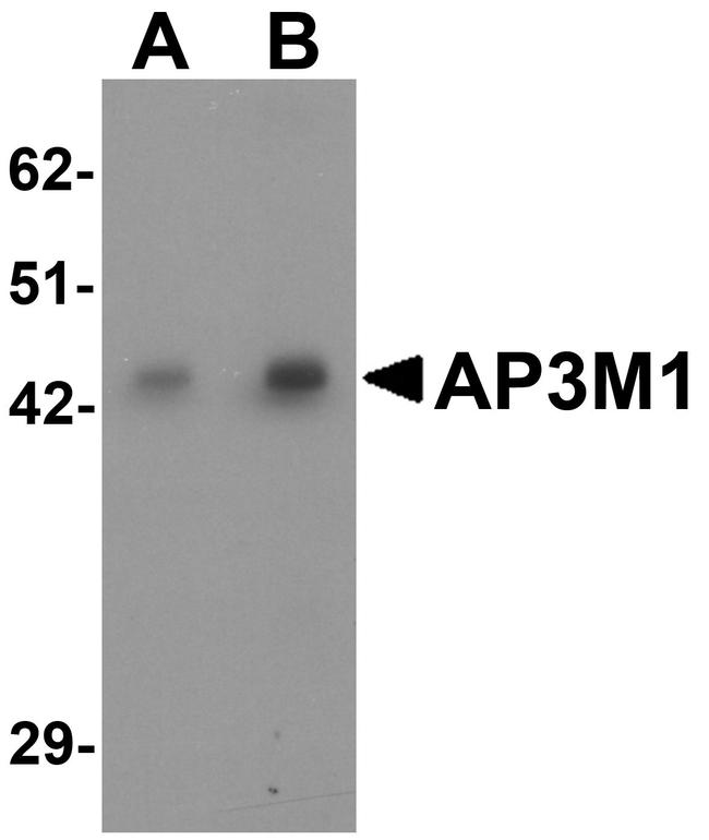 AP3M1 Antibody in Western Blot (WB)
