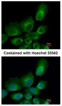 UBE2B Antibody in Immunocytochemistry (ICC/IF)