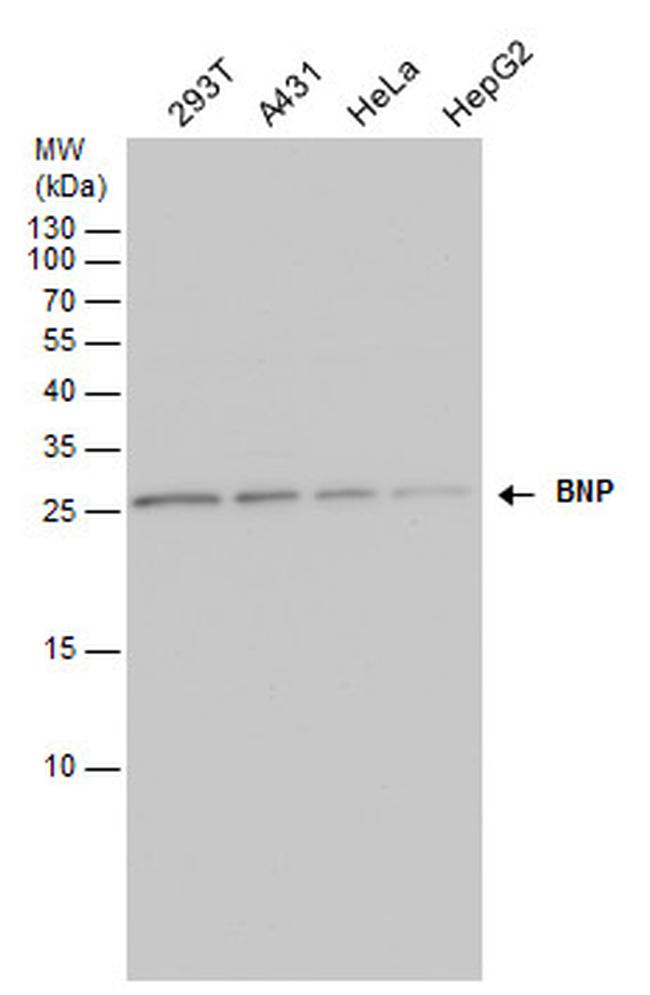 BNP Antibody in Western Blot (WB)
