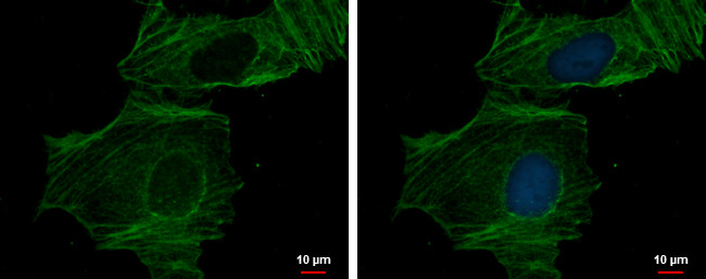 alpha-Cardiac Actin Antibody in Immunocytochemistry (ICC/IF)