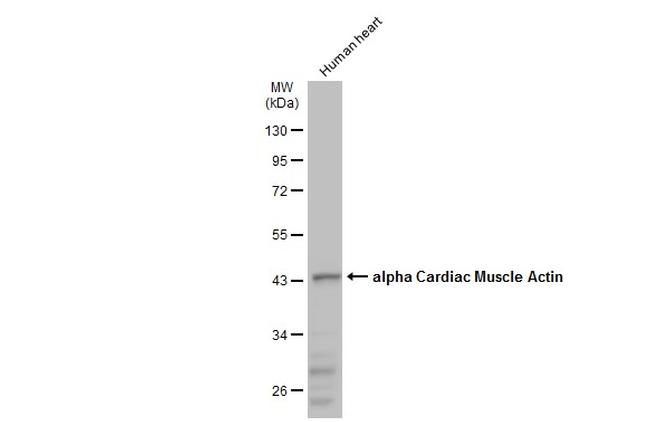 alpha-Cardiac Actin Antibody in Western Blot (WB)