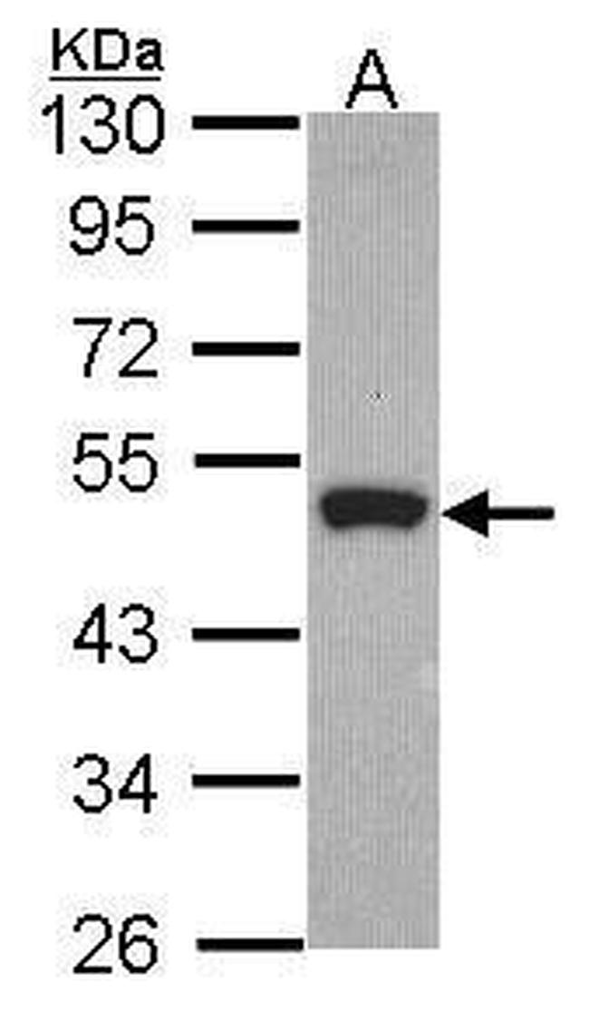 Peripherin Antibody in Western Blot (WB)