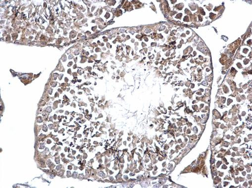 DMC1 Antibody in Immunohistochemistry (Paraffin) (IHC (P))