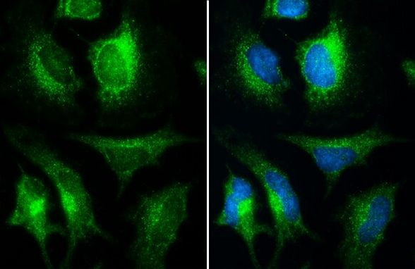 INPP5F Antibody in Immunocytochemistry (ICC/IF)