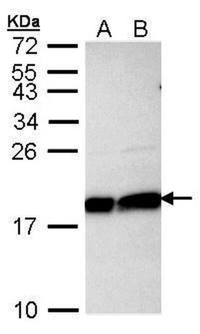 UBE2L3 Antibody in Western Blot (WB)