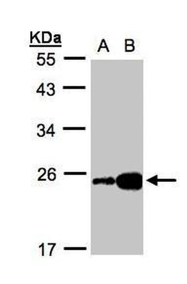 FABP6 Antibody in Western Blot (WB)